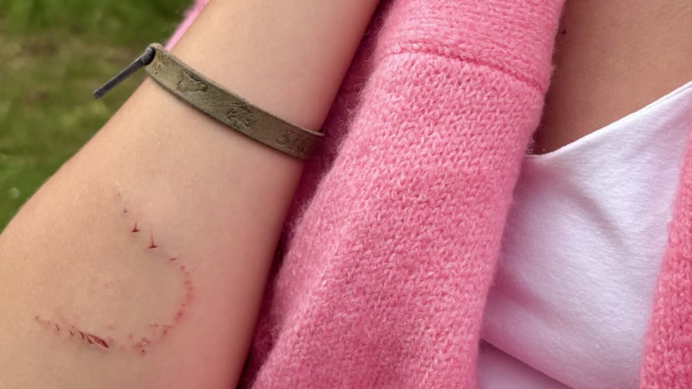 Juni, 13, blev biten av g&auml;dda: 