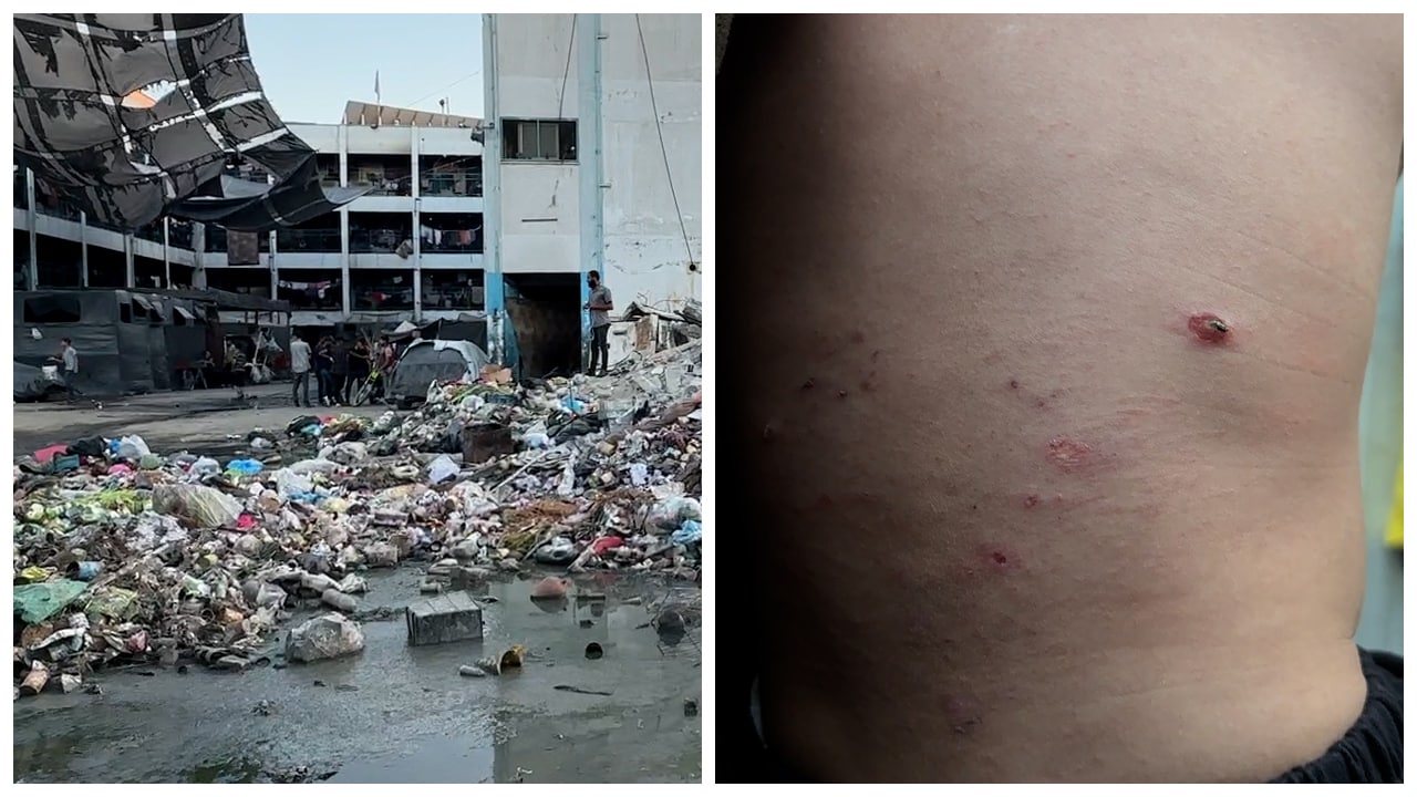 Misär, utslag och smuts – så är livet i flyktinglägret i Gaza