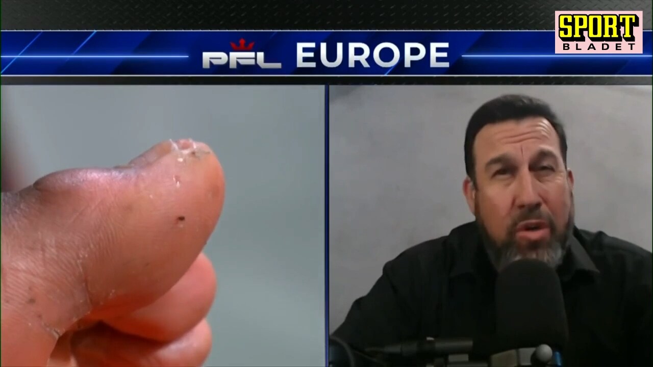 Se märkliga scenerna när obesegrade fightern förlorar – hade sticka i stortån