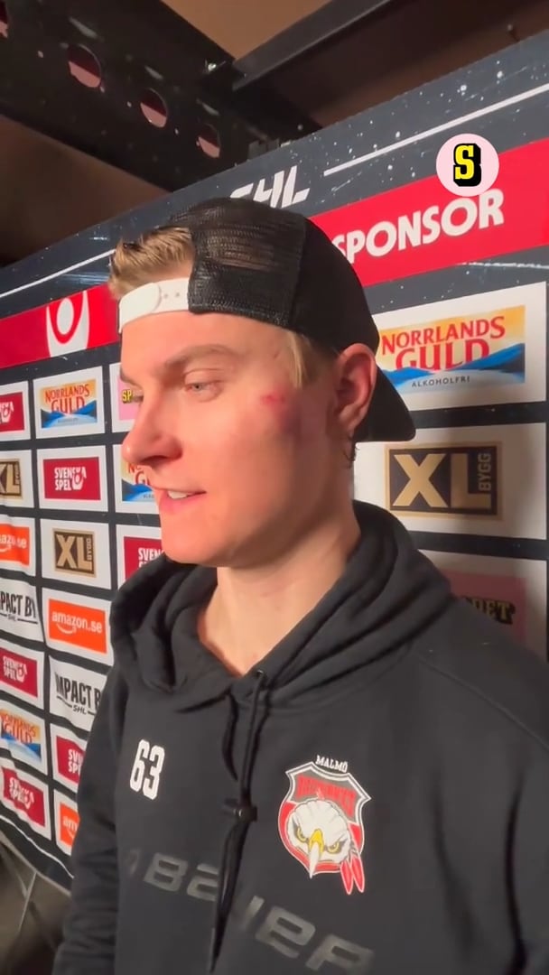 Fick skott i ansiktet: ”Small bra ”