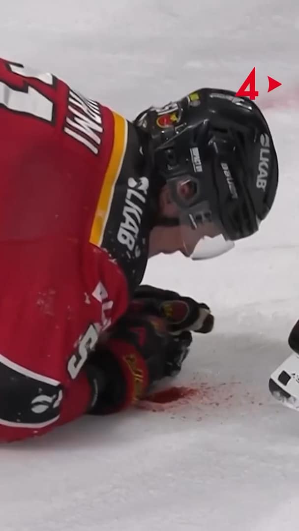 Otäcka bilder – spottar blod