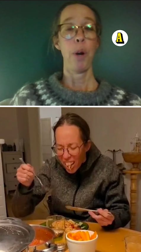 Ovanliga sjukdomen: ”Brutala elstötar i ansiktet”