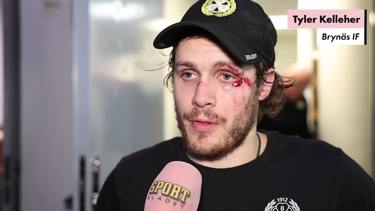 Kelleher om skräckskadan: “modellkarriären är helt klart över”