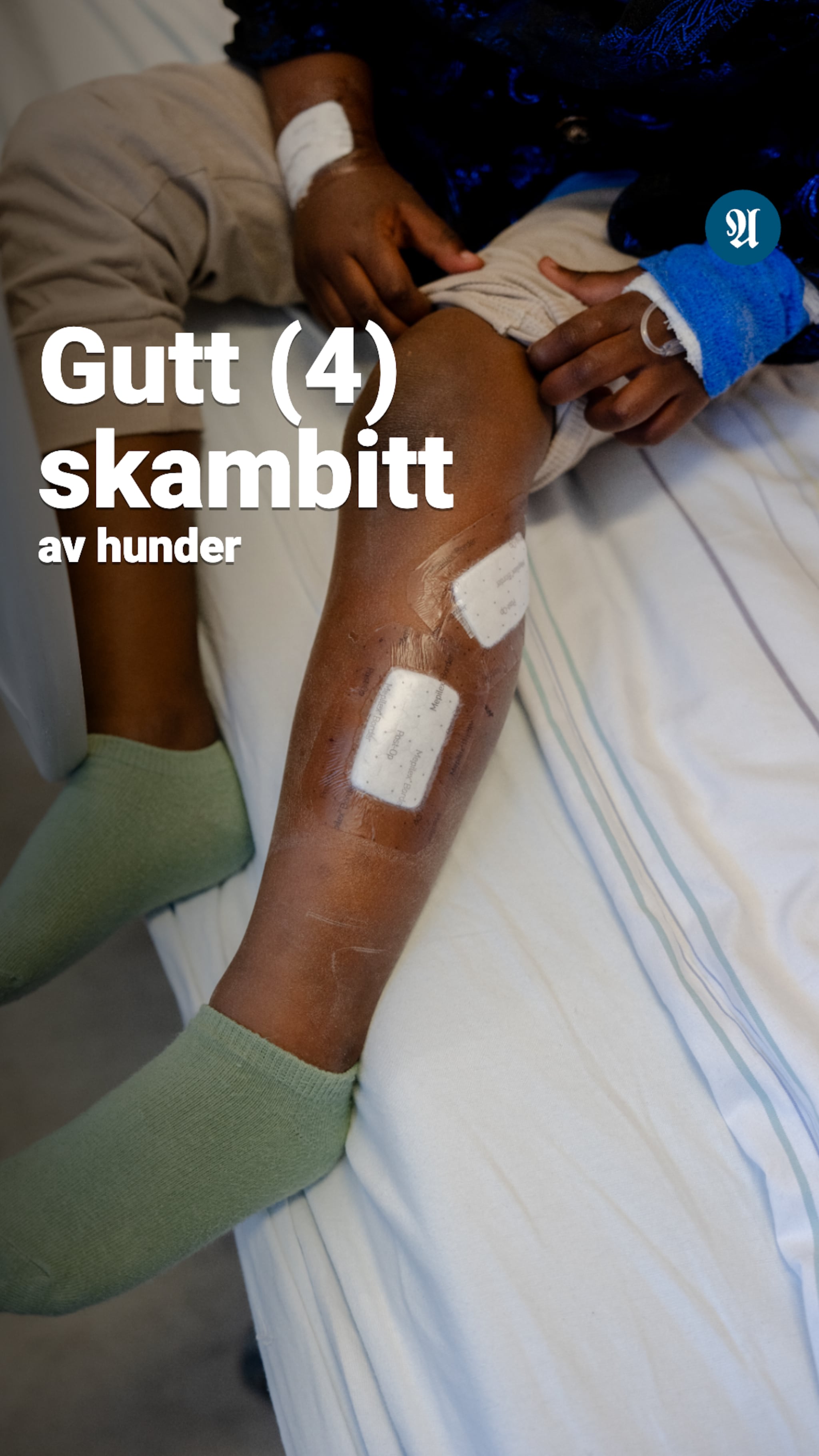 Gutt (4) skambitt