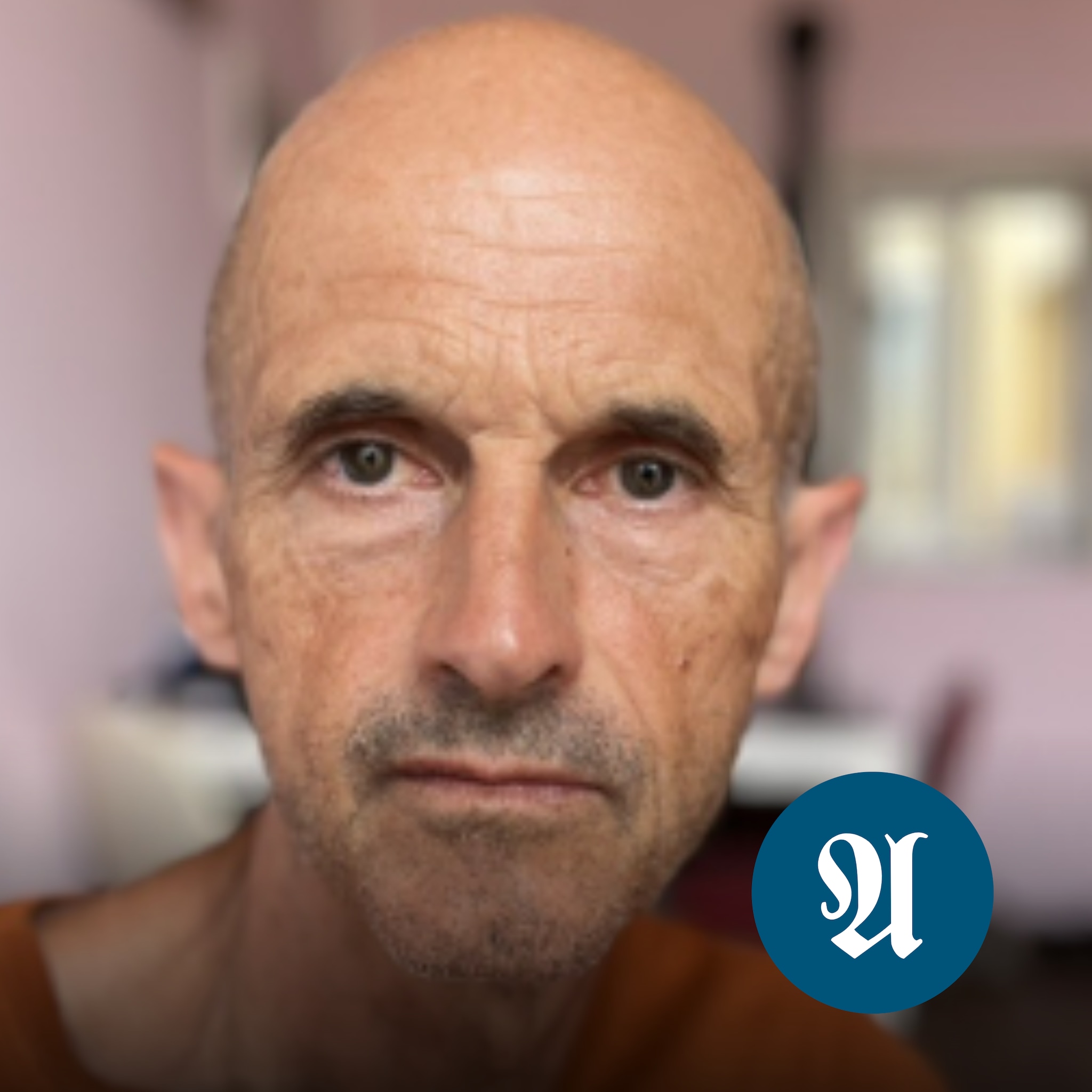 Knut dro til Tyrkia for få håret tilbake