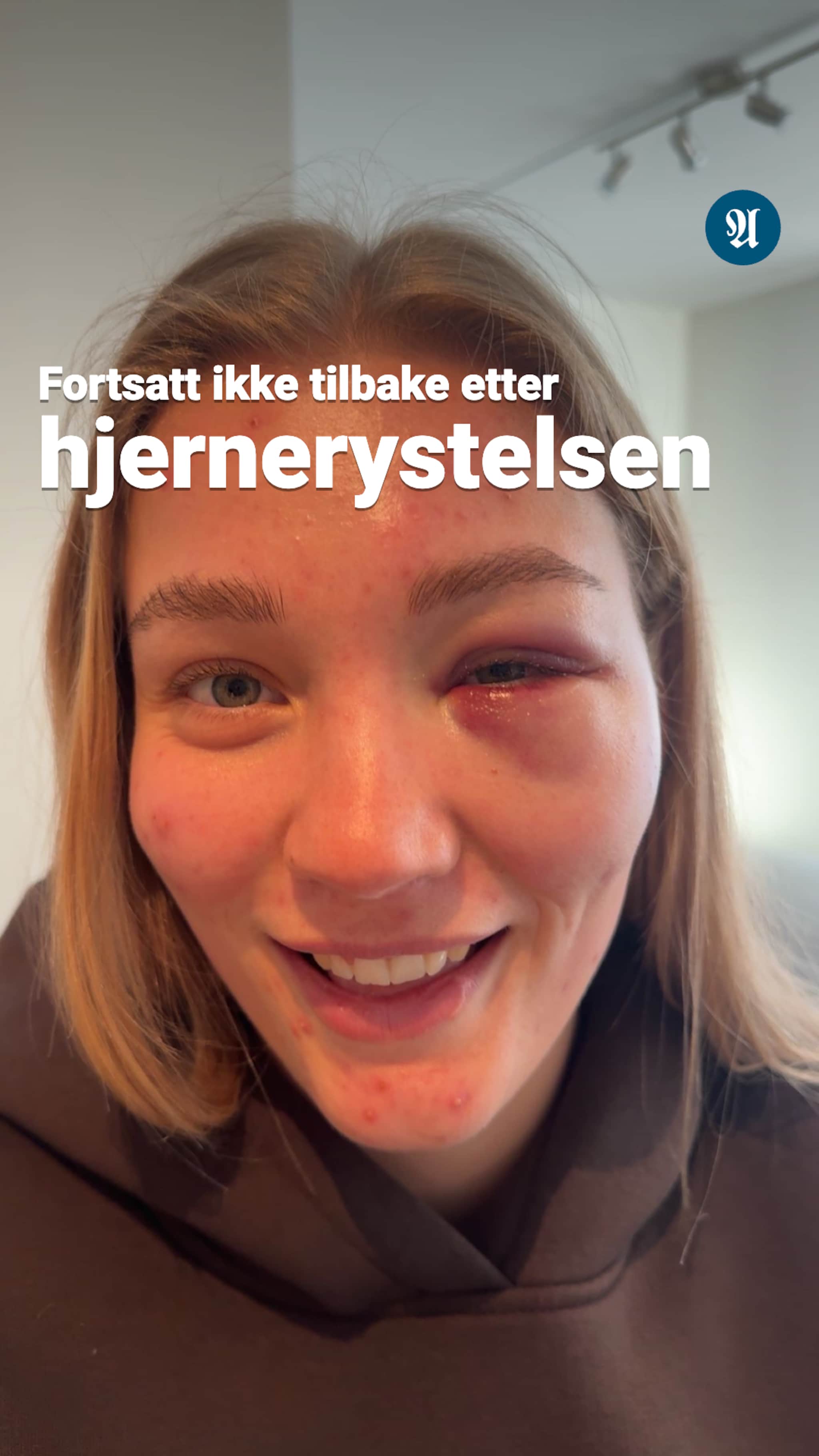 RBK-profilen ute på ubestemt tid