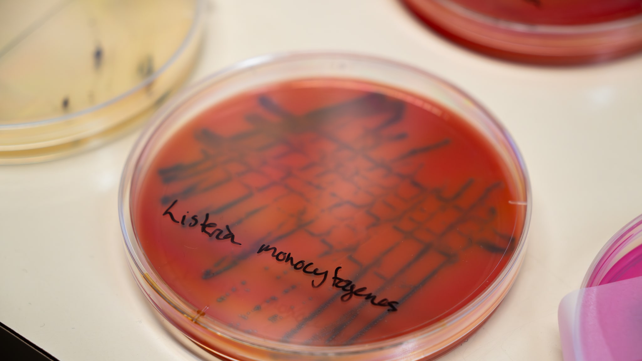 Her tester de for listeria: – Potensielt dødelig