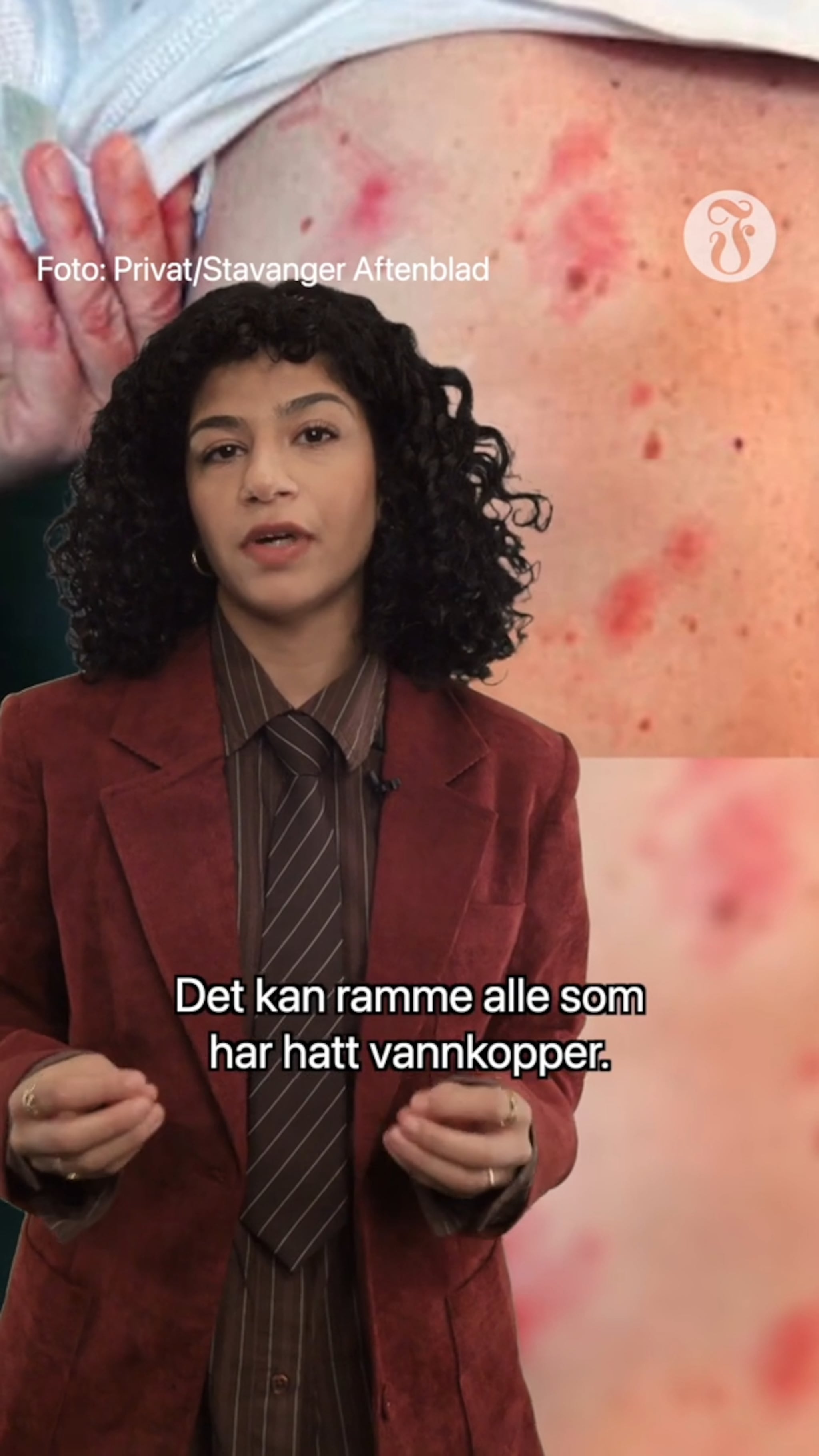 - Det svei, det stakk det brant