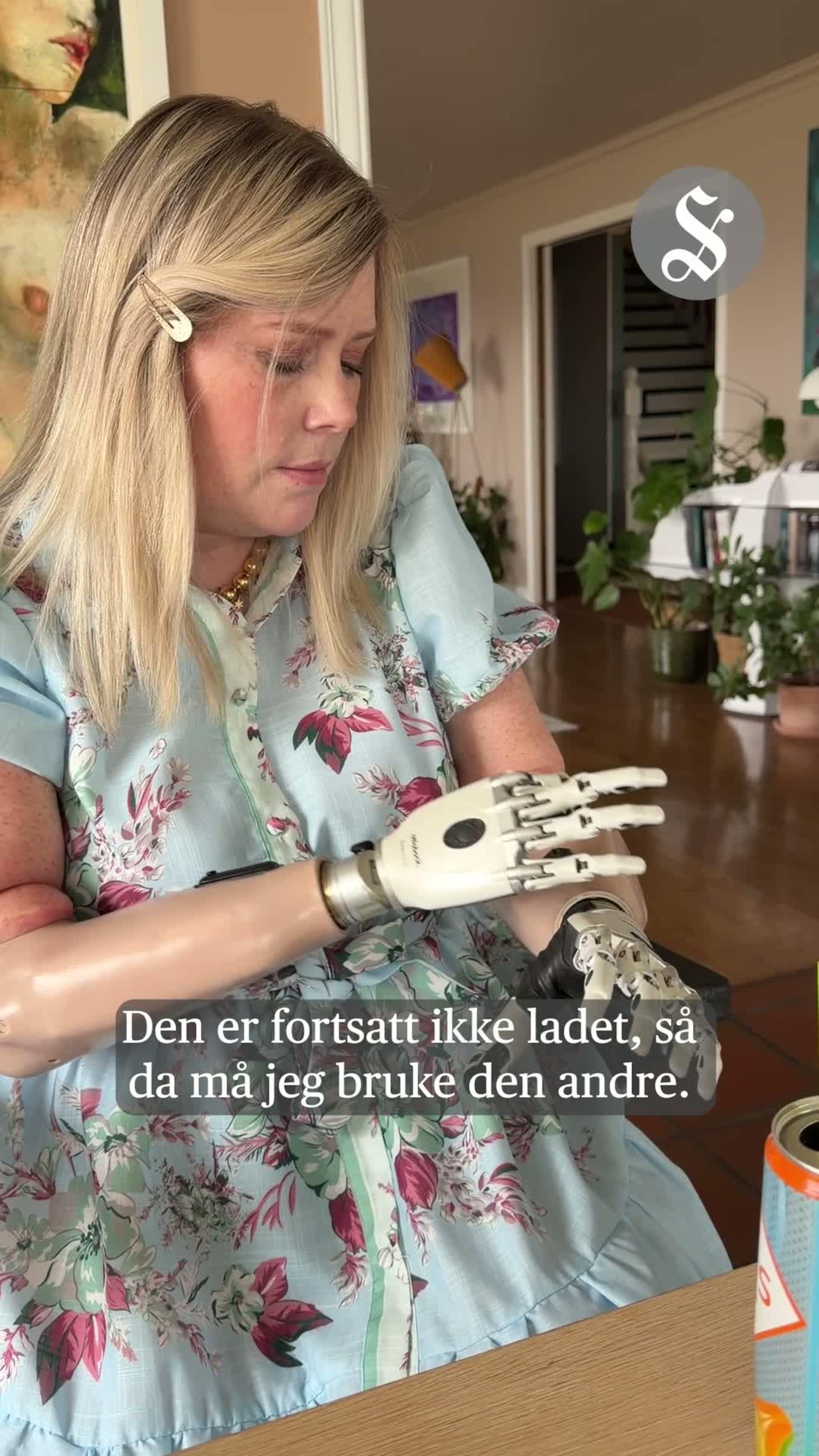 Mistet armer og bein – skal tilbake i jobb