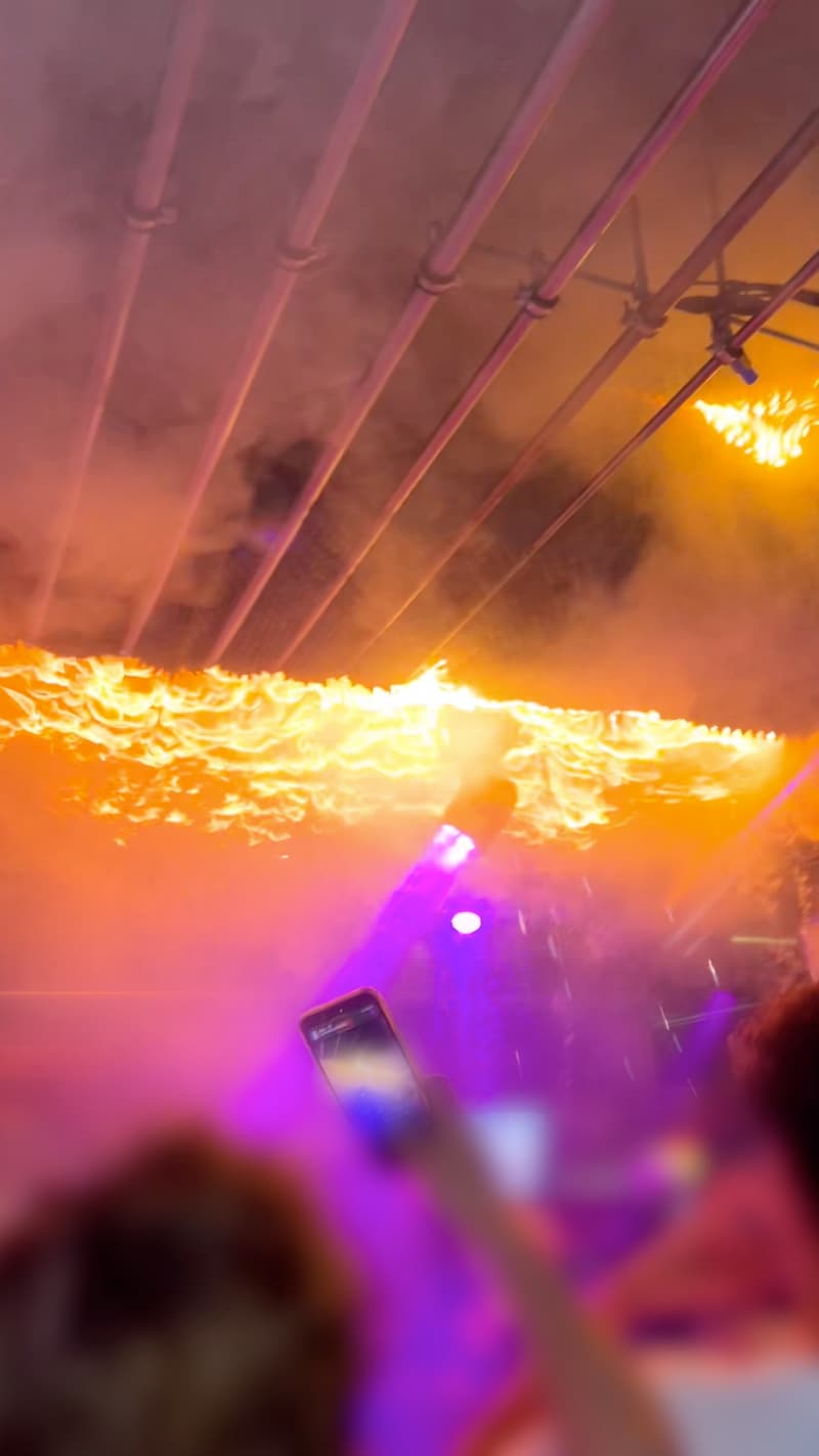 Overlege på brannskadeavdeling: – Helt ekstremt