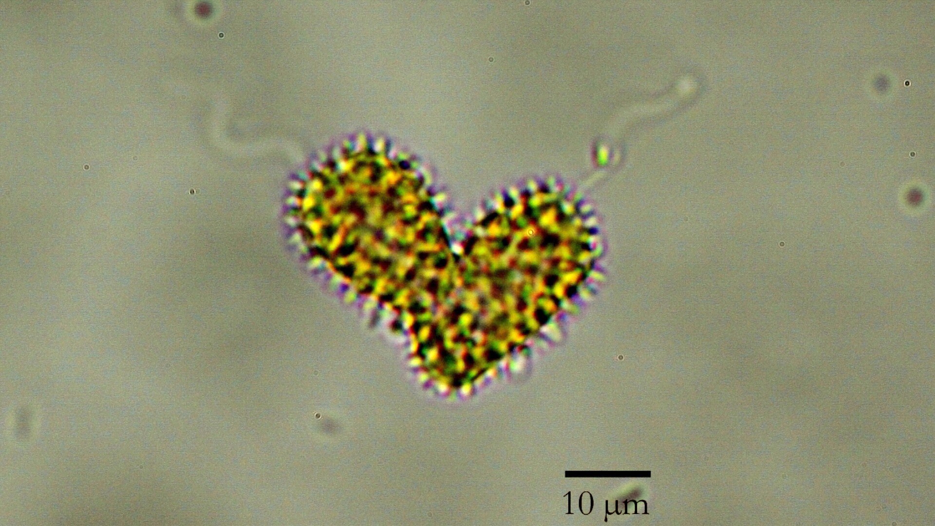 Giftig alge i Oslofjorden: – Kjempedårlig