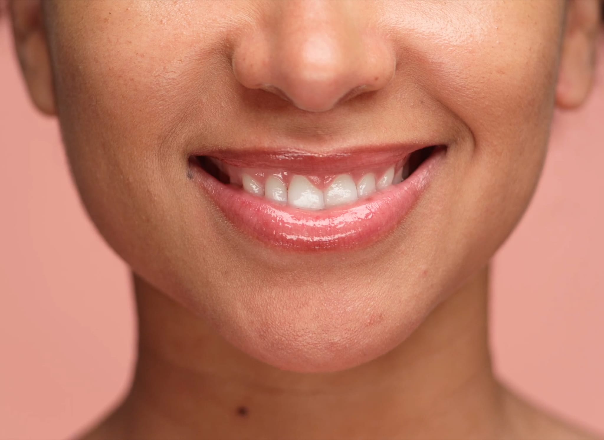 Hjemmebleking av tenner: De fleste produkter skuffer i test