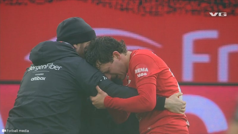 Brann-back operert for brudd i ansiktet
