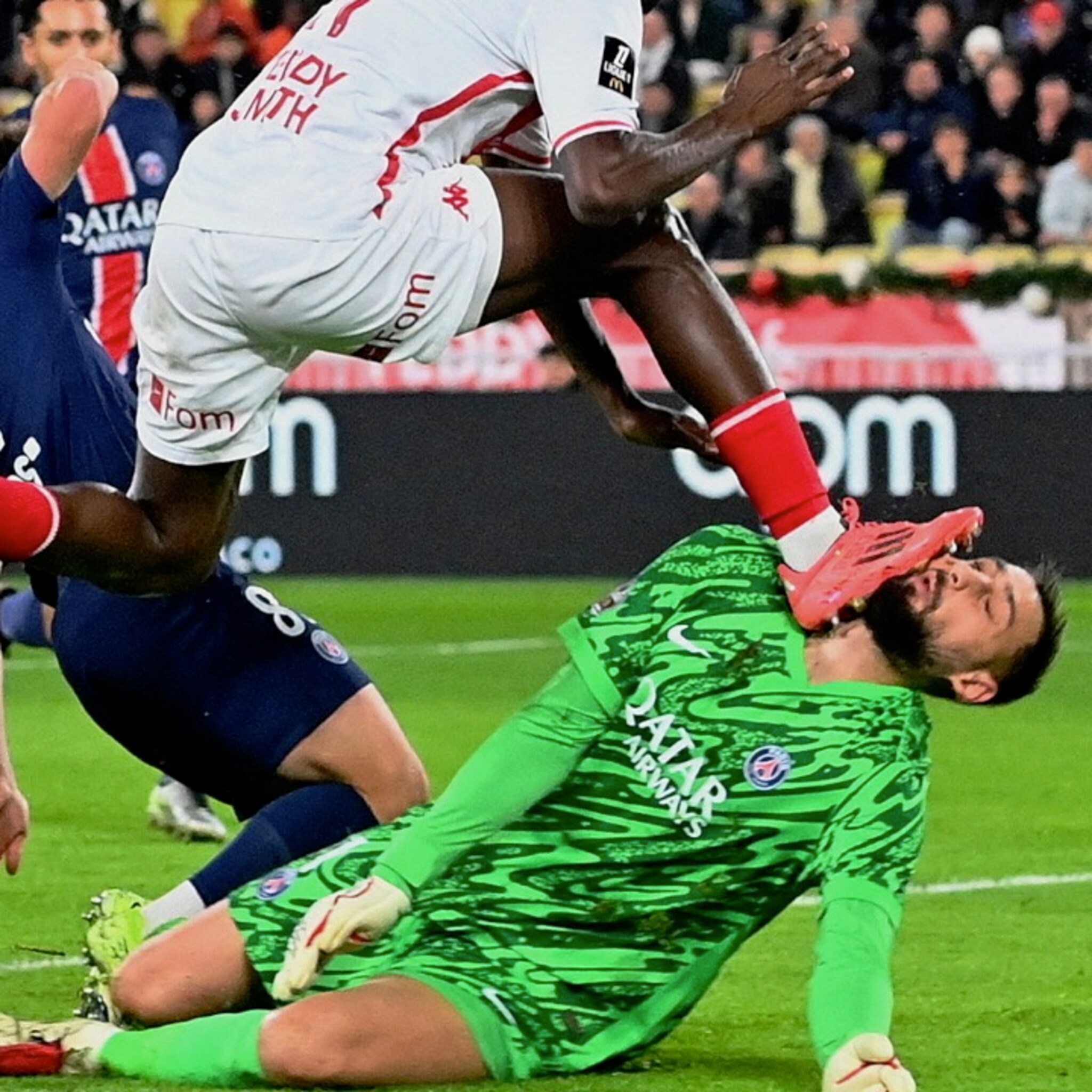 Grusom skade for PSG-keeper - ansiktet fullt av sår